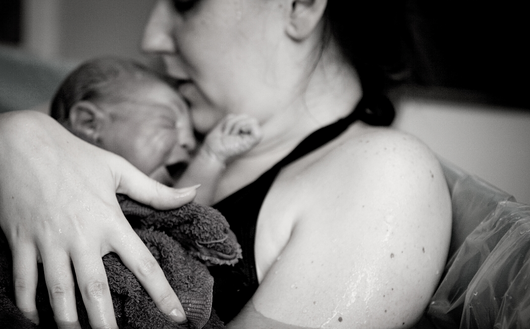 13 Tipps zu Pflege von Dammrissen, Geburtsverletzungen und Kaiserschnittnarben